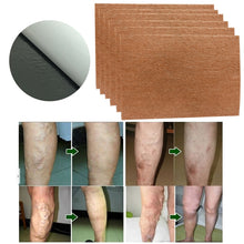 Load image into Gallery viewer, Varicose Veins Treatment Patches
