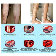 Load image into Gallery viewer, Varicose Veins Treatment Patches